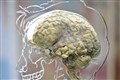‘Reversed brain’ linked to lower social and communication abilities – study