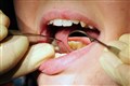 Text reminders could improve teenagers’ tooth brushing habits