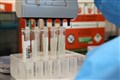 Staying prepared for future pandemics ‘absolutely vital’ – scientist
