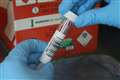 Coronavirus deaths ‘rising sharply’, medical director warns