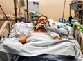 Corinne lost her hands and legs because of sepsis