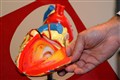 New technology to monitor individuals’ heart abnormalities given green light