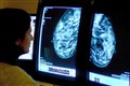 Powerful drug combination for breast cancer ‘could save thousands of lives’