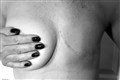 Mastectomy support group tells of ‘constant battle’ to keep Facebook page open
