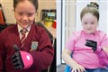 Eight-year-old girl born with one hand receives ‘life-changing’ bionic arm