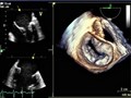 3D cam gets to heart of matter at Raigmore Hospital