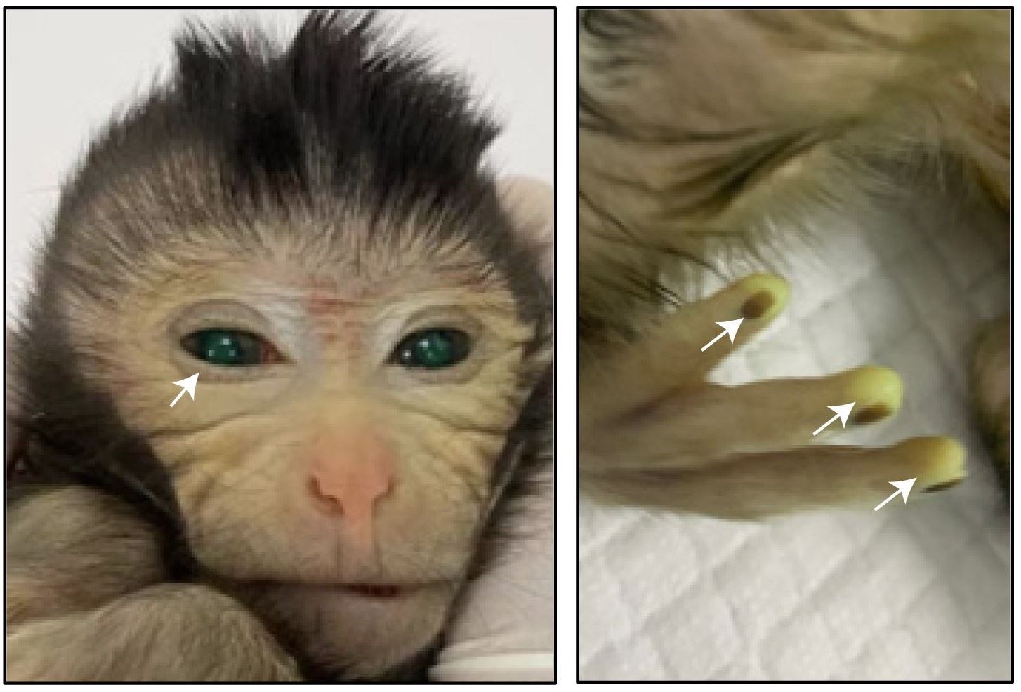 Images showing the green fluorescence signals in different body parts of a three-day-old chimeric monkey (Cao et al/Cell)