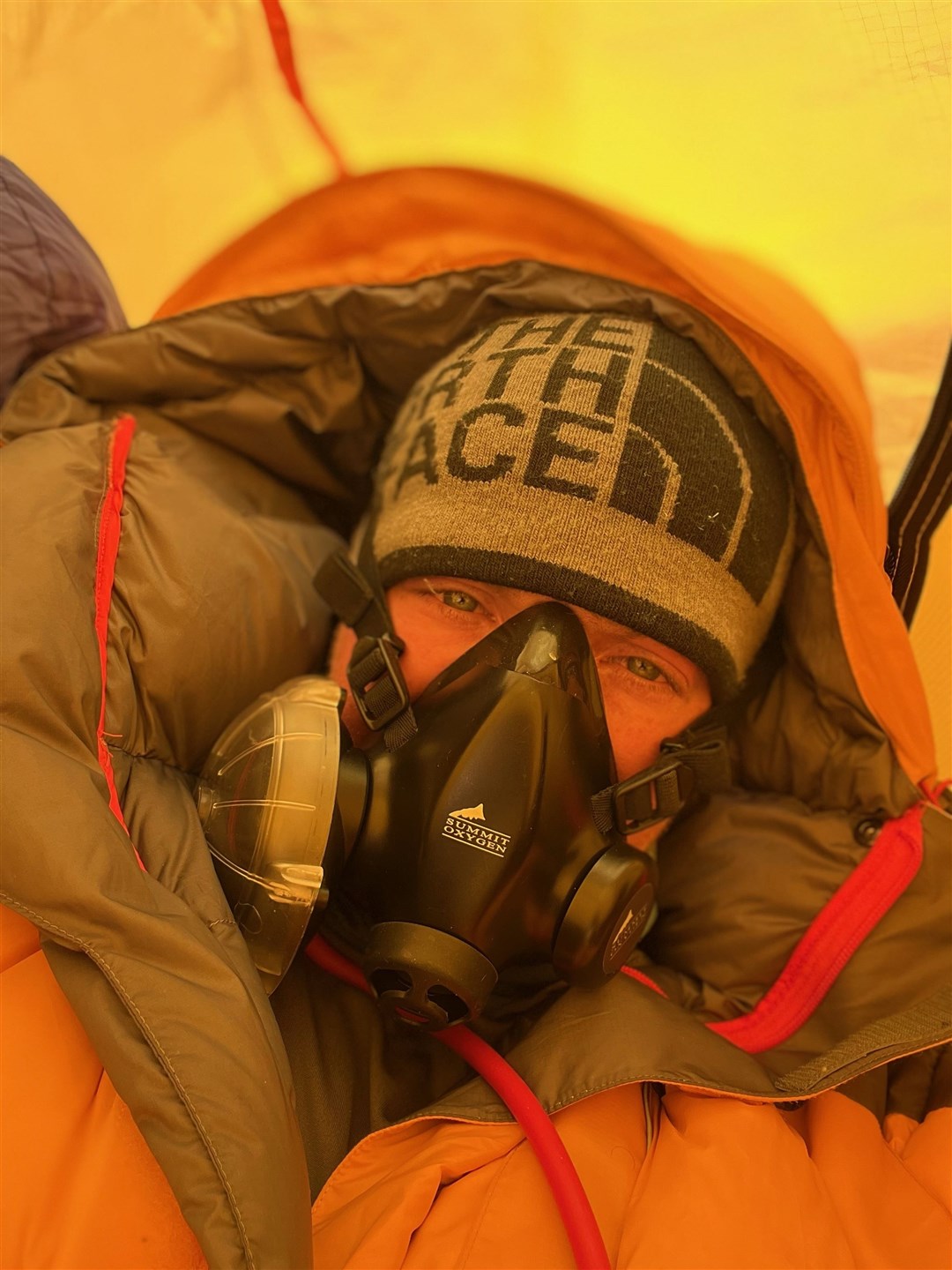 Sam Cairns had to battle several health issues to reach the summit of the world's highest peak.