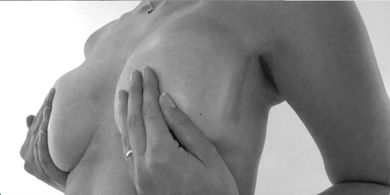 (Amanda Chard/Mastectomy Network/PA)