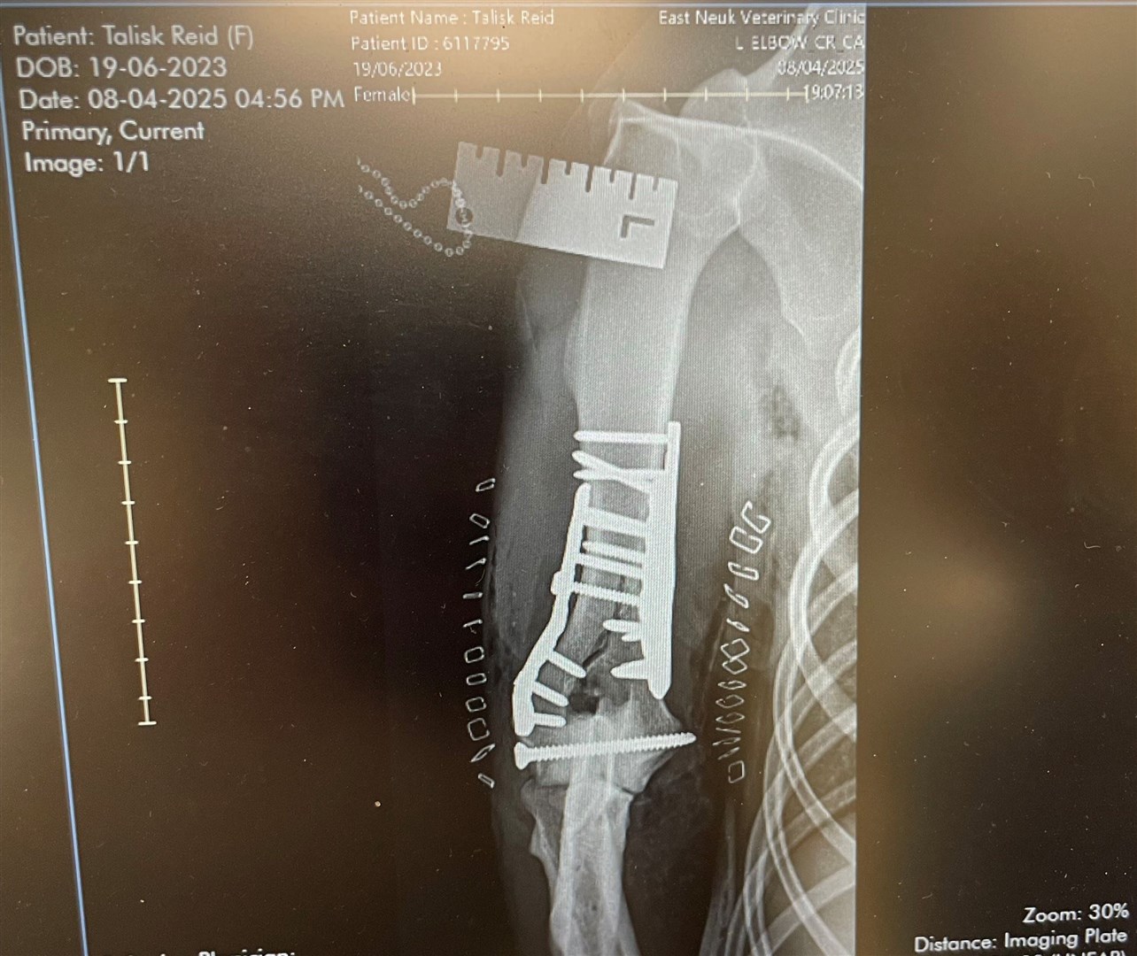 On the mend... the remarkable job done by the specialists in Fife.