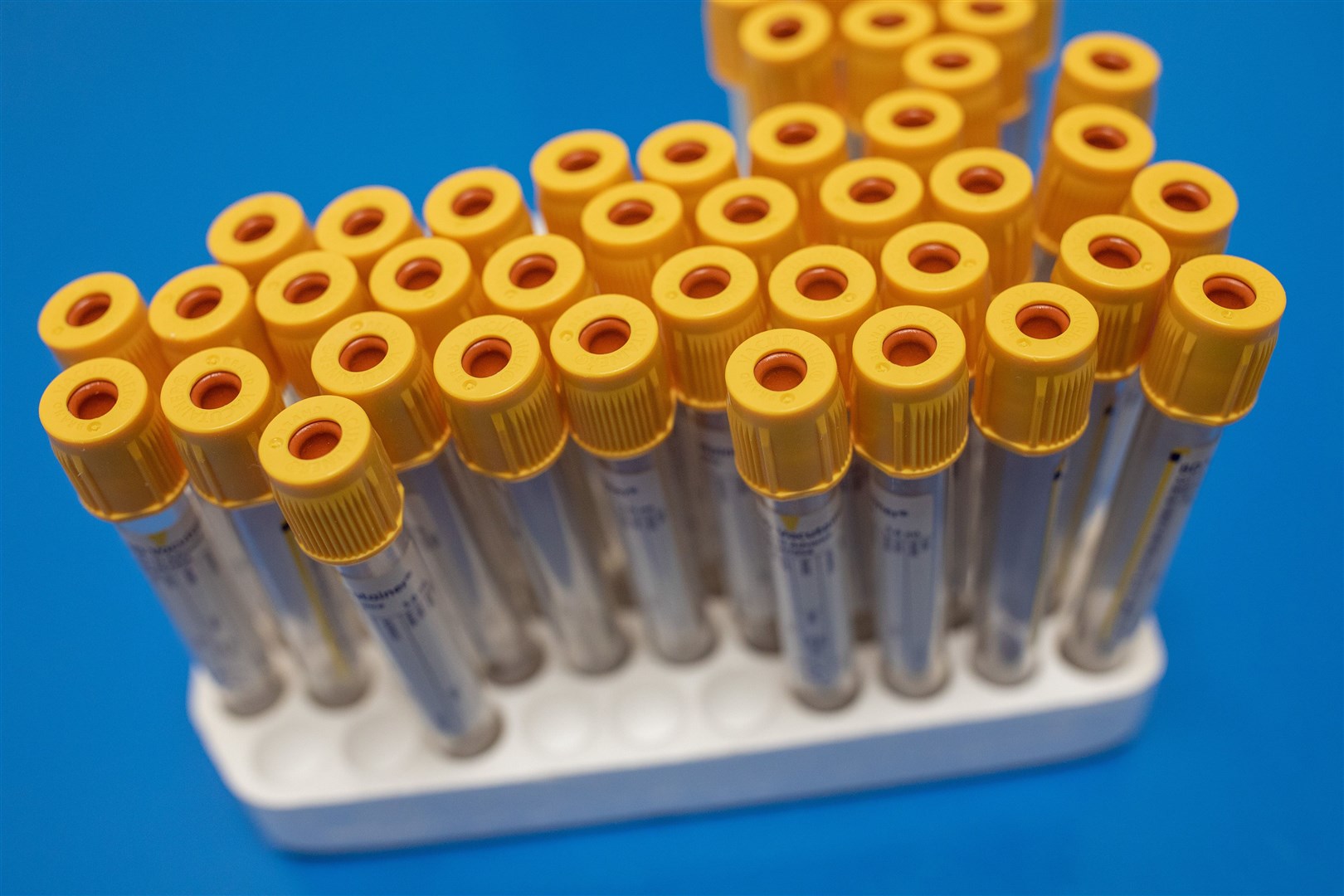 AstraZeneca said testing has been paused while it investigates ‘a potentially unexplained illness’ associated with its vaccine trials (Simon Dawson/PA)