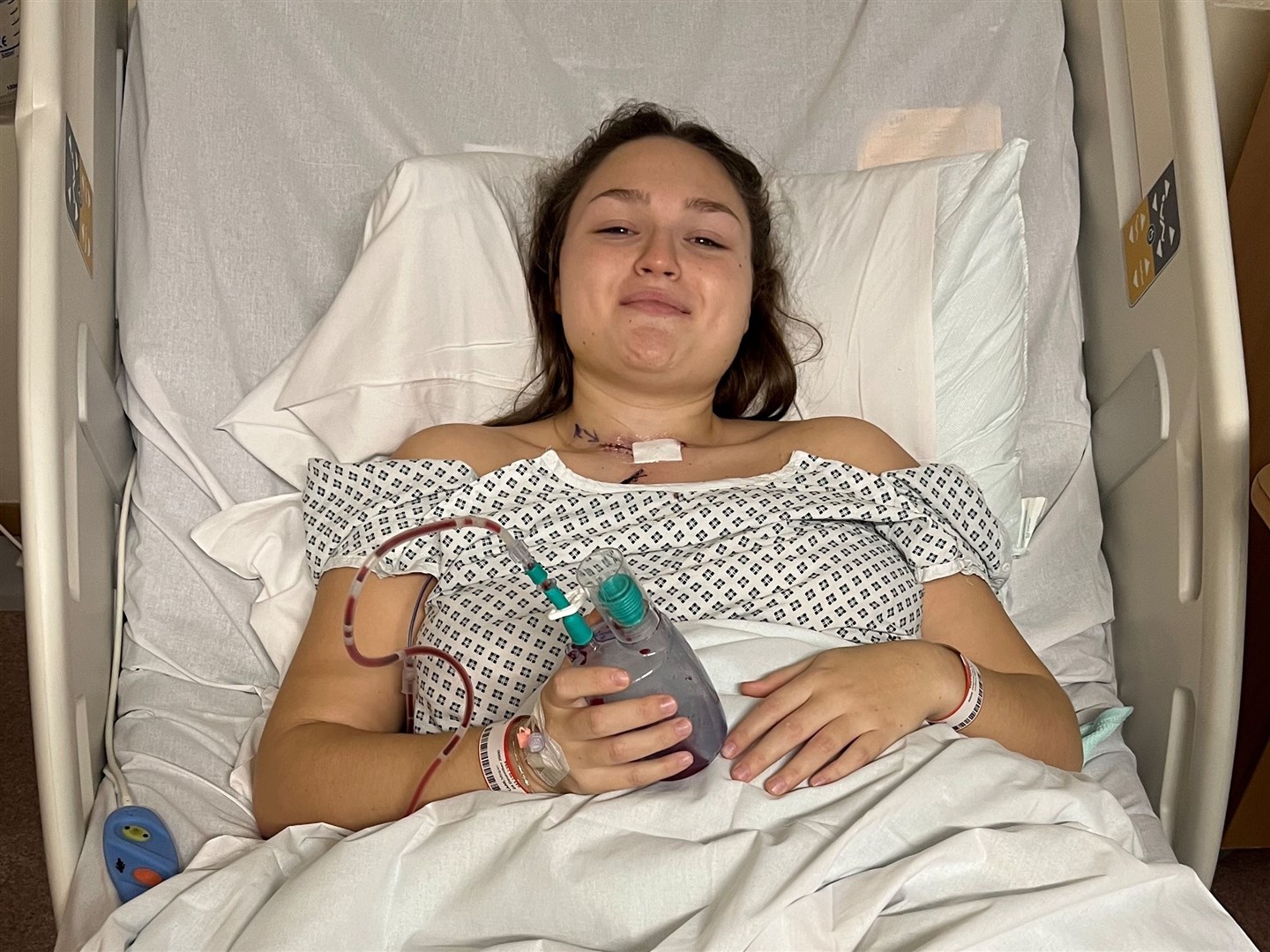 Megan Carr at William Harvey Hospital in Ashford after her second surgery