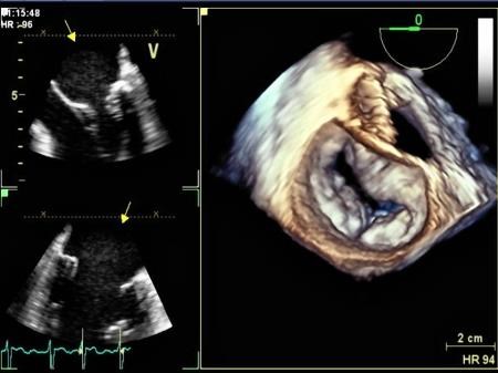 The two scans on the left are conventional ultrasound images; the one on the right is a 3-dimensional image