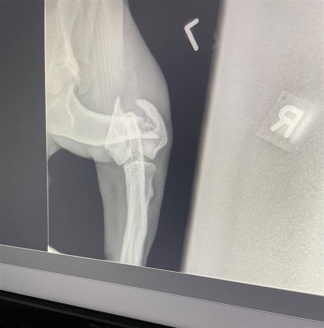 An x-ray showing the breaks in one of her legs.